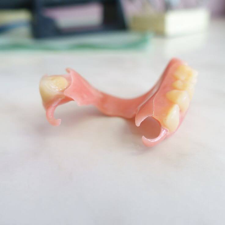 Removable Dental Prostheses