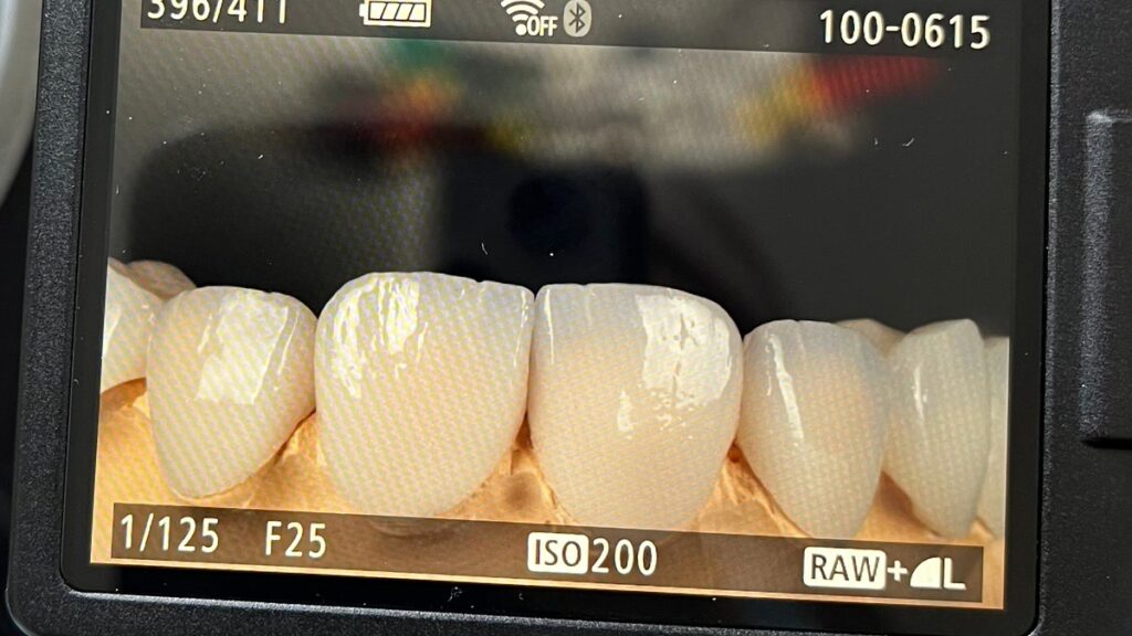 Whitened teeth photographed at Camellia Polyclinic in Beirut.